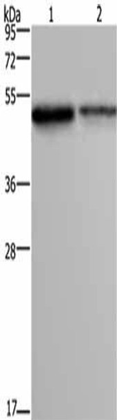 FOXA1 Antibody (PACO17876)