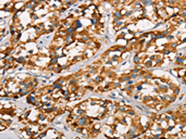 SPR Antibody (PACO19231)