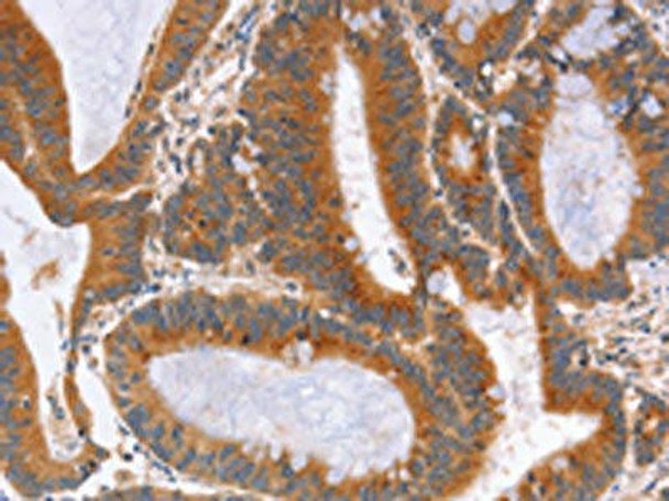 NOD1 Antibody (PACO19392)