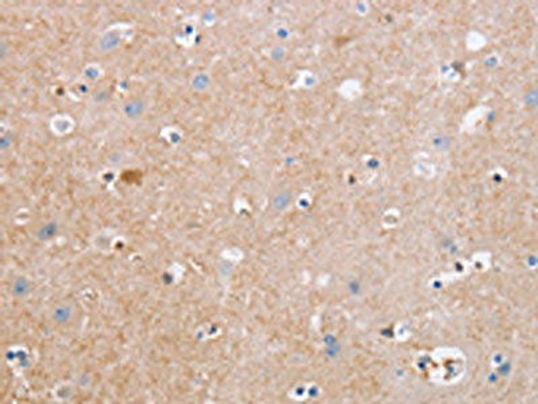 CDC7 Antibody (PACO19451)