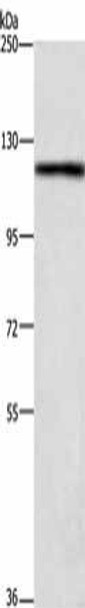 TSPYL2 Antibody (PACO19476)