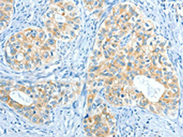 COL4A2 Antibody (PACO19492)