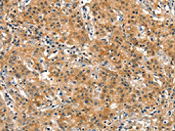 DNM2 Antibody (PACO19587)