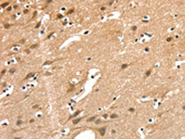 AIMP1 Antibody (PACO19596)