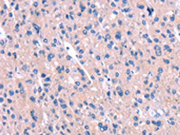 ENPP4 Antibody (PACO19603)