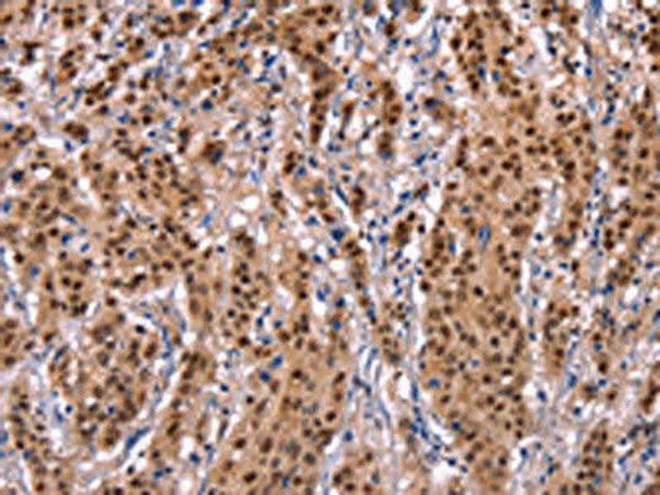 EFNA5 Antibody (PACO19606)