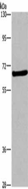 FEM1B Antibody (PACO19652)