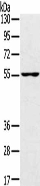 UBP1 Antibody (PACO19932)