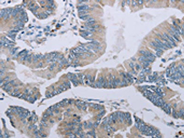 MRGPRX1 Antibody (PACO20038)