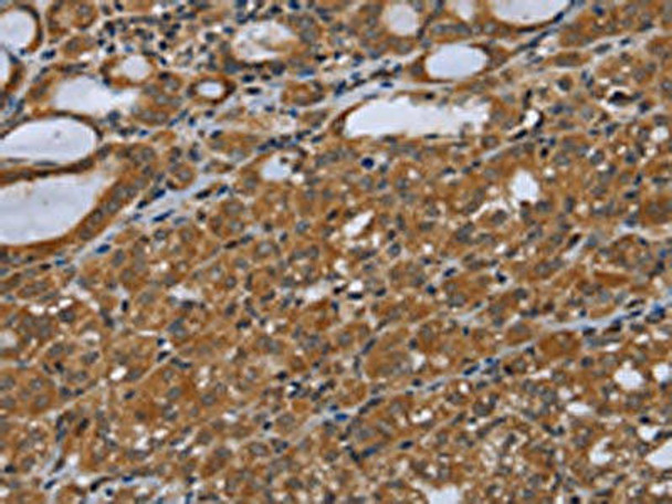 UHRF2 Antibody (PACO20088)