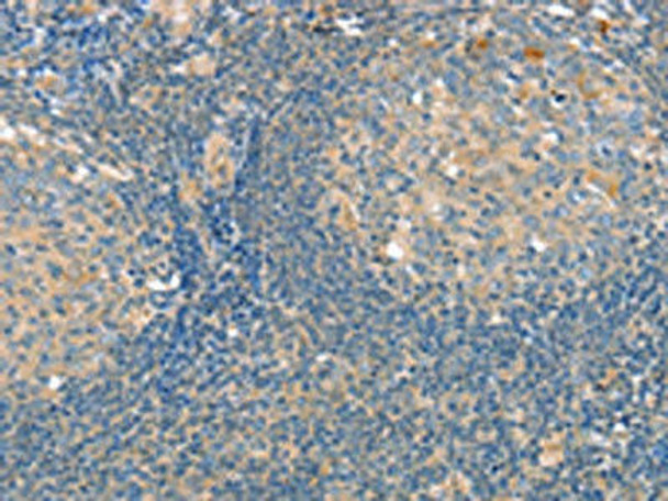 SLIT3 Antibody (PACO20545)