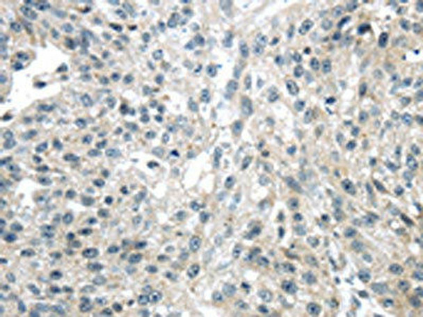 ULBP1 Antibody (PACO20837)