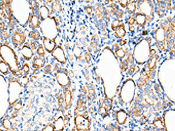 KRT7 Antibody (PACO20972)