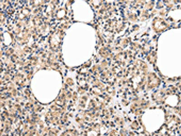 MUC1 Antibody (PACO20980)