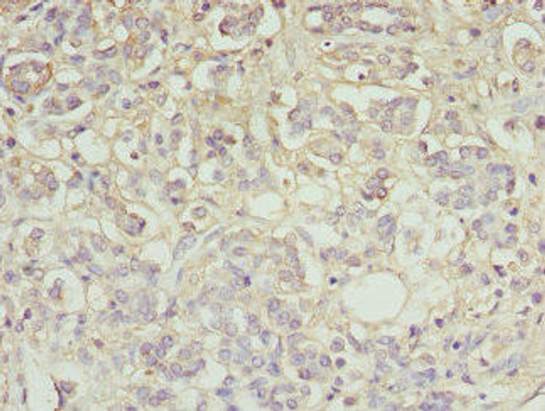Ttr Antibody (PACO30874)