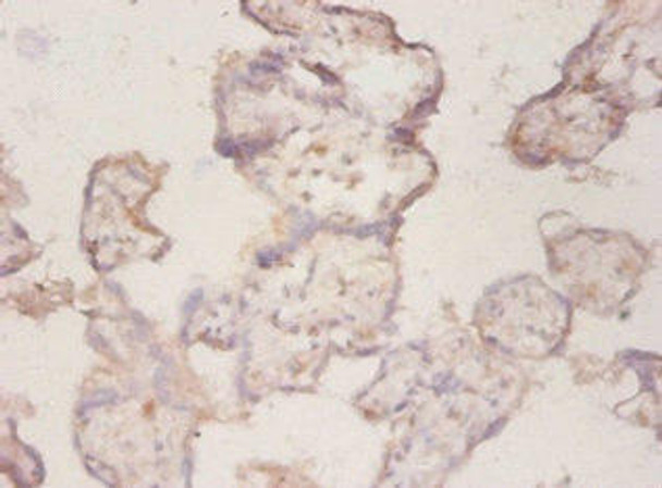 CP Antibody (PACO33484)