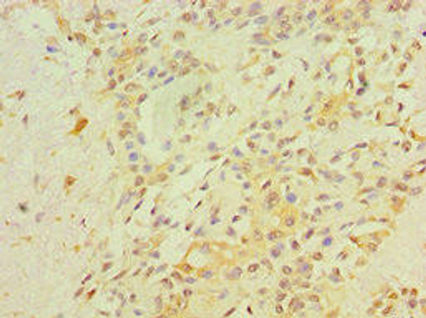 RB1 Antibody (PACO43827)