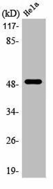 LTBR Antibody (PACO01033)