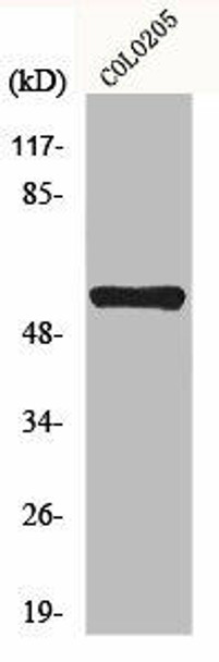 MITF Antibody (PACO01067)