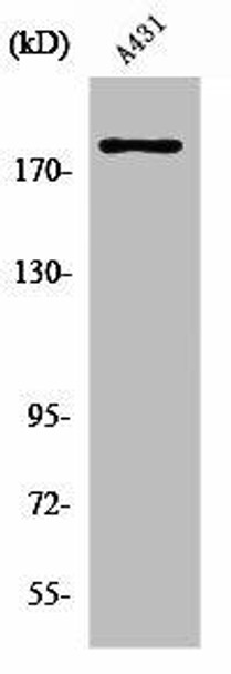 ERBB2 Antibody (PACO01157)