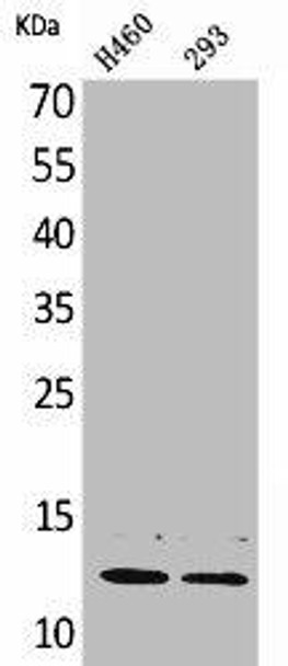 TFPI2 Antibody (PACO01873)