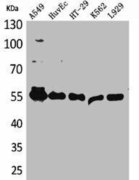 FSCN1 Antibody (PACO01925)