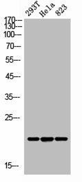 ANG Antibody (PACO02209)