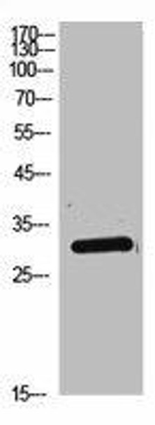 DKK1 Antibody (PACO02227)