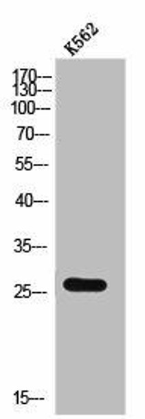 CMTM2 Antibody (PACO02501)