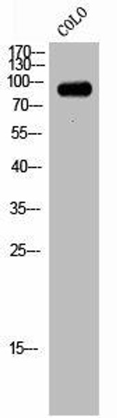 NCAPH Antibody (PACO02771)