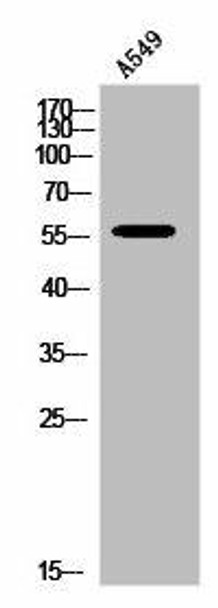 LIPC Antibody (PACO02877)