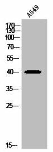 PGD Antibody (PACO02969)