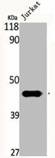 CKM Antibody (PACO06374)