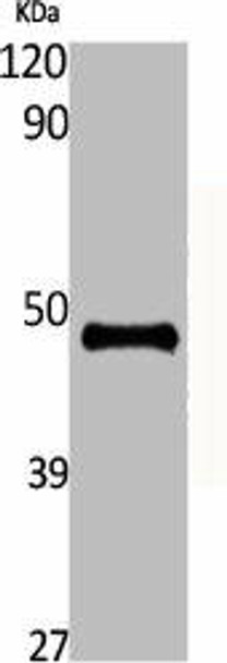 ENO2 Antibody (PACO06460)