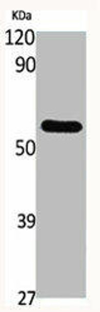 GCK Antibody (PACO06506)