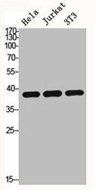 HDAC8 Antibody (PACO06543)