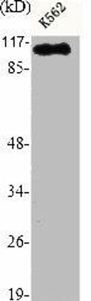 HDAC9 Antibody (PACO06548)