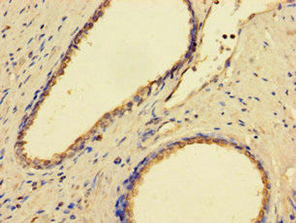 GMPPB Antibody (PACO42694)