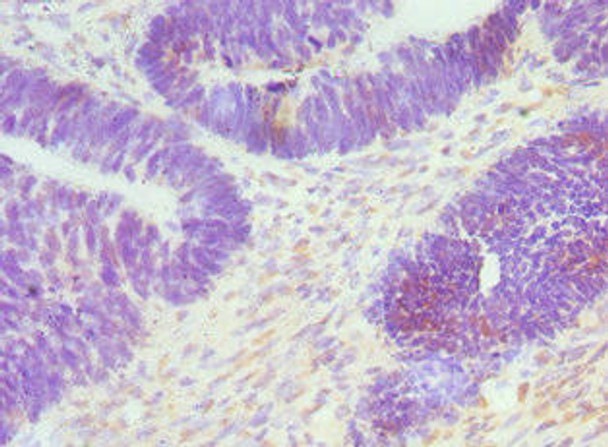CTCF Antibody (PACO43008)