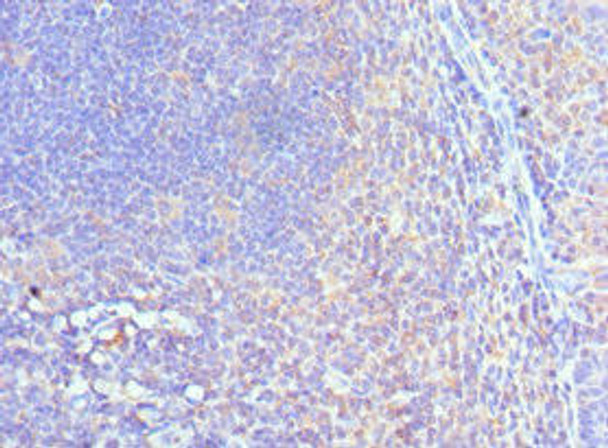 CUL5 Antibody (PACO43068)