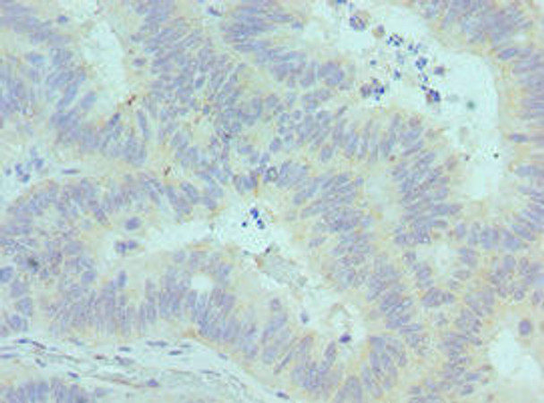 CADM1 Antibody (PACO43134)