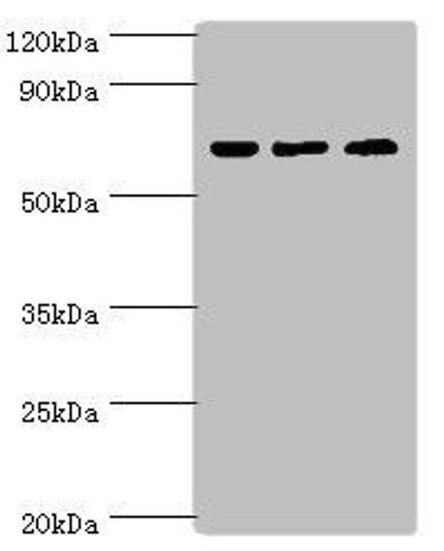 PIAS2 Antibody (PACO43210)