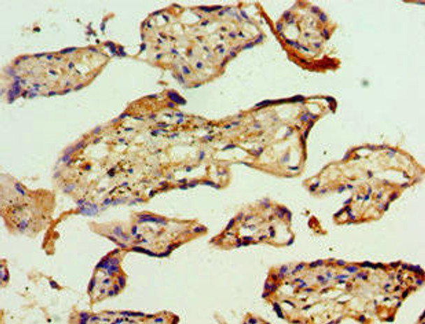 ACAT2 Antibody (PACO43408)