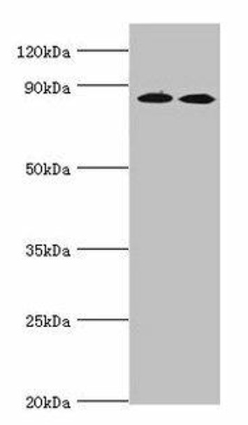 AMPD3 Antibody (PACO43426)