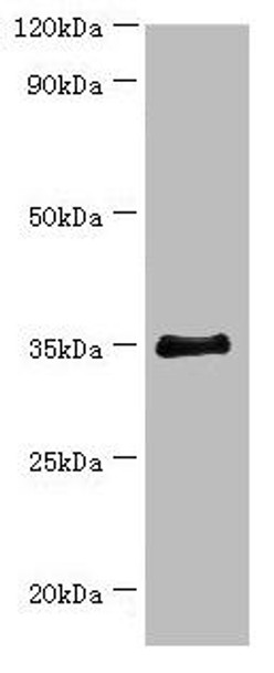 BCAT2 Antibody (PACO43485)