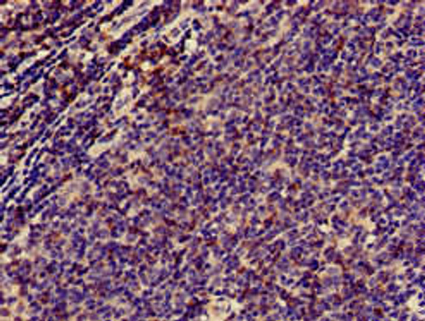 CD3E Antibody (PACO51402)