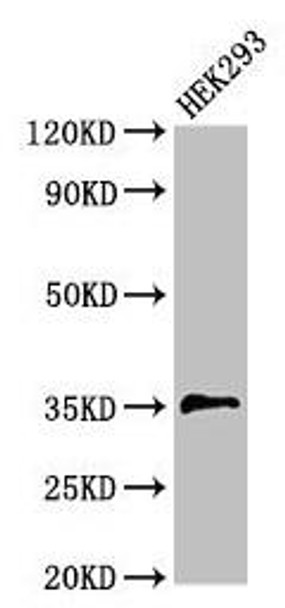 PPT1 Antibody (PACO51854)