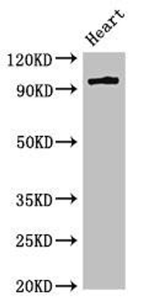 PRKD3 Antibody (PACO51866)