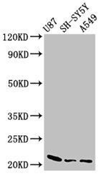 NDUFS4 Antibody (PACO53702)