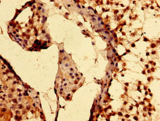 EPAS1 Antibody (PACO53894)